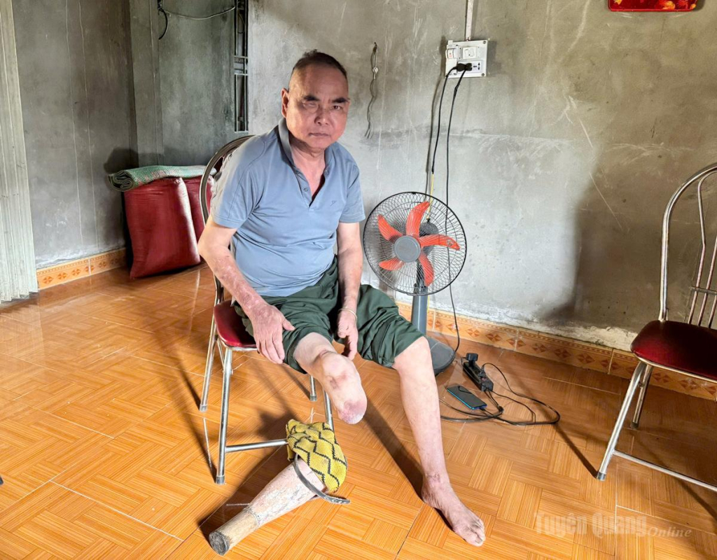 Cựu chiến binh Sùng Sào Minh, thôn Na Lan, xã Nấm Dẩn, tỉnh Tuyên Quang bị hỏng mắt phải và cụt chân phải.