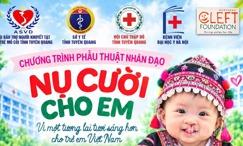 Tuy&ecirc;n Quang triển khai chương tr&igrave;nh phẫu thuật miễn ph&iacute; cho trẻ hở m&ocirc;i, h&agrave;m ếch